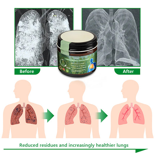 Official Store:Lercea™ 👑Mullein Clear Lung Repair Cream - endorsed by the British Thoracic Society to support lung health🎉🎉