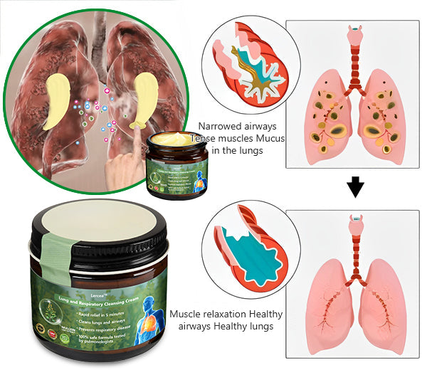 Official Store:Lercea™ 👑Mullein Clear Lung Repair Cream - endorsed by the British Thoracic Society to support lung health🎉🎉